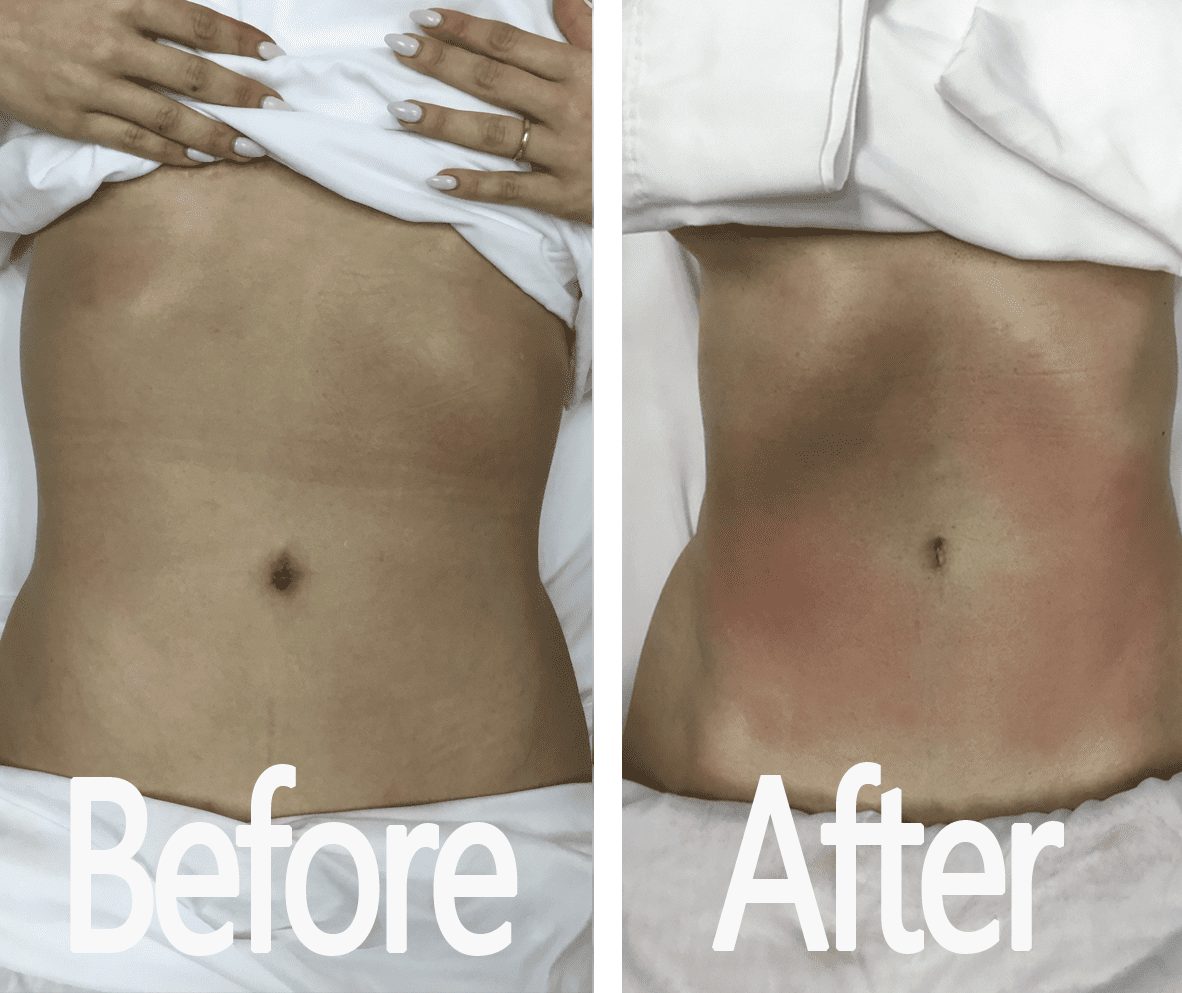 Customer 1945 - Carolina Pintos Therapy 713-474-4774