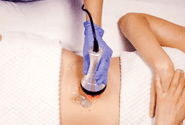 Radio Frequency Therapy for skin tightening