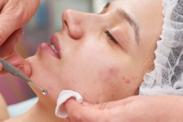 All You Need to Know About Skin Cycling