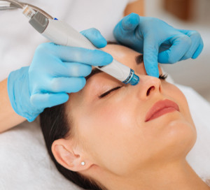 HydroFacial chemical-peel