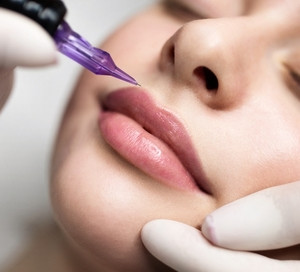 Lip-Blushing-2 chemical-peel