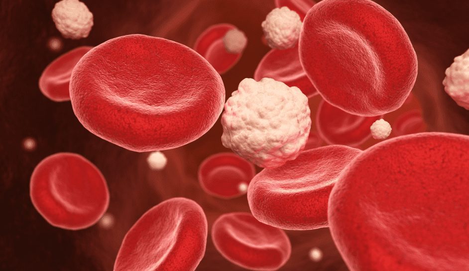 High Sugar Diets Can Negatively Impact Surgery Recovery