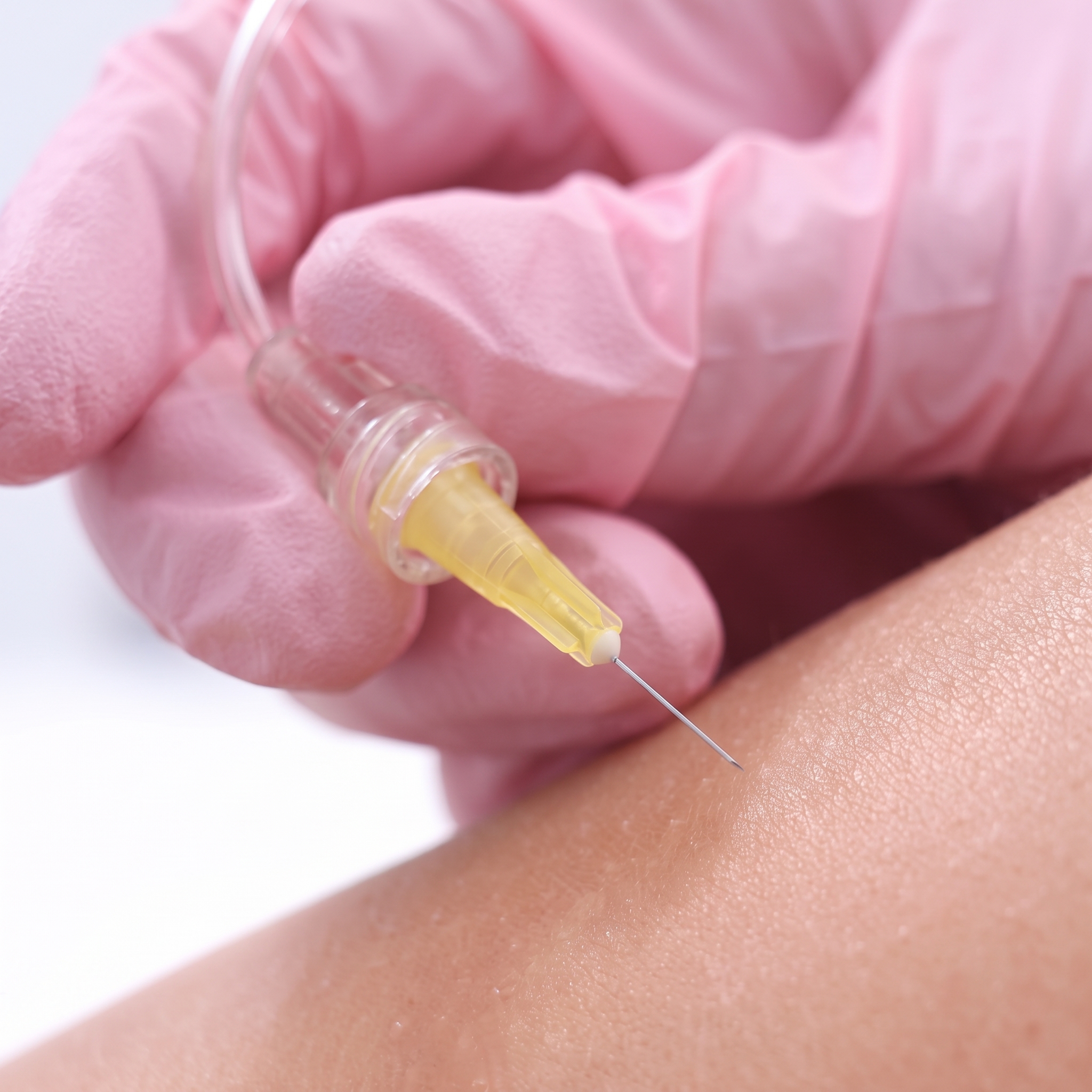 Close-up of a fine injectable carboxytherapy needle held in a pink-gloved hand near the skin
