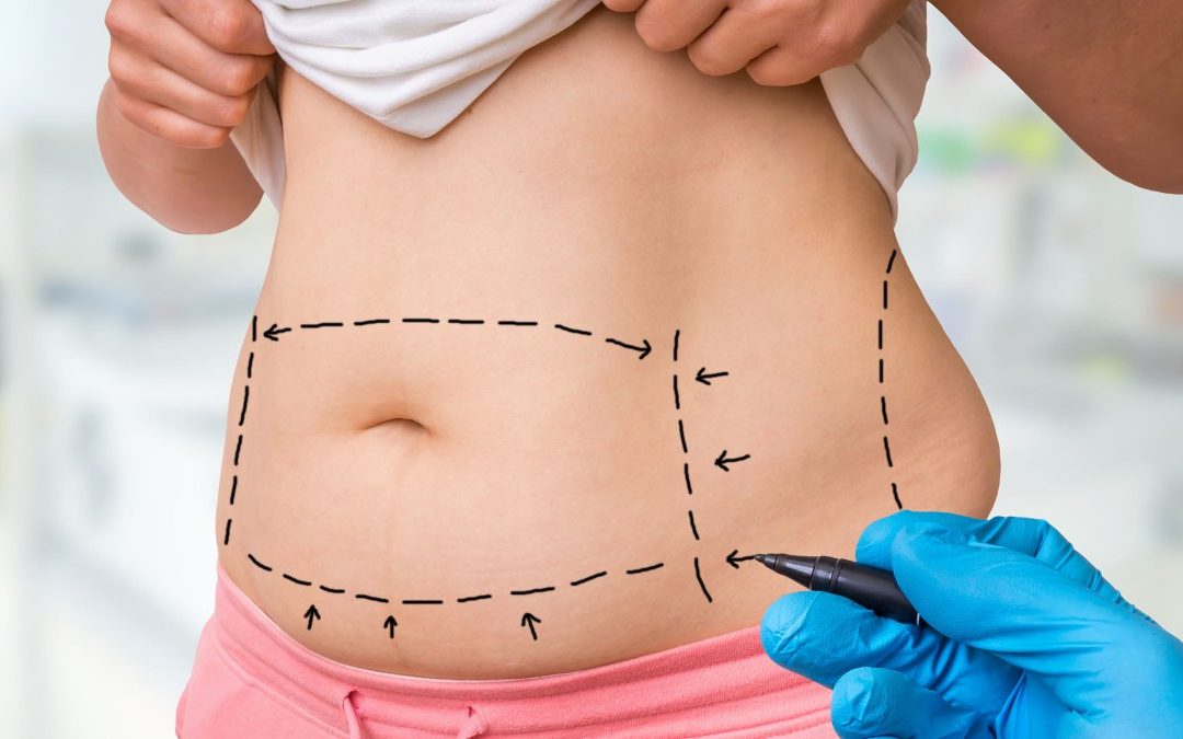 Can You Use Heat After Body Contouring Surgery? Why Hot Stones and Heating Pads Are Dangerous