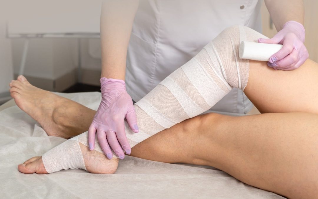 Lipedema and Lymphatic Drainage: What Helps, and What It Cannot Change